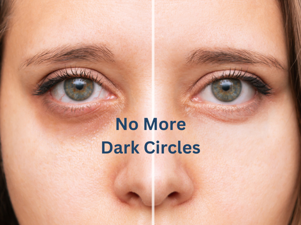 Goodbye to Dark Circles